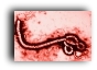 El ébola, el barullo y los ecologistas